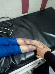 22528345_1471424756274975_4002184497979488348_n